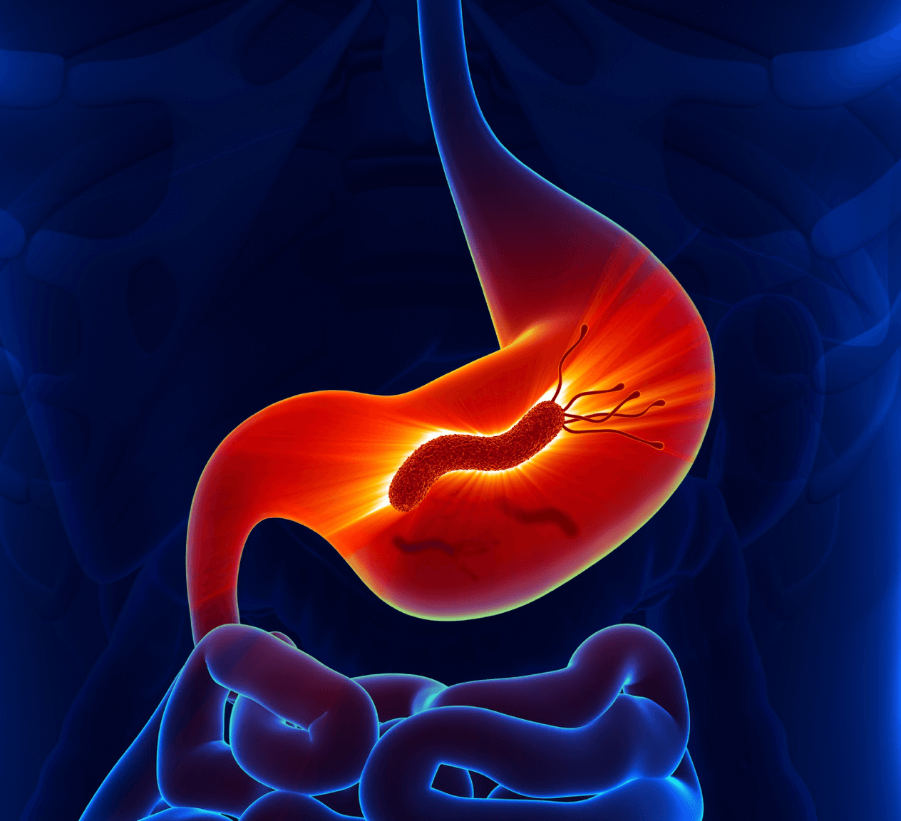 Peptic ulcer disease