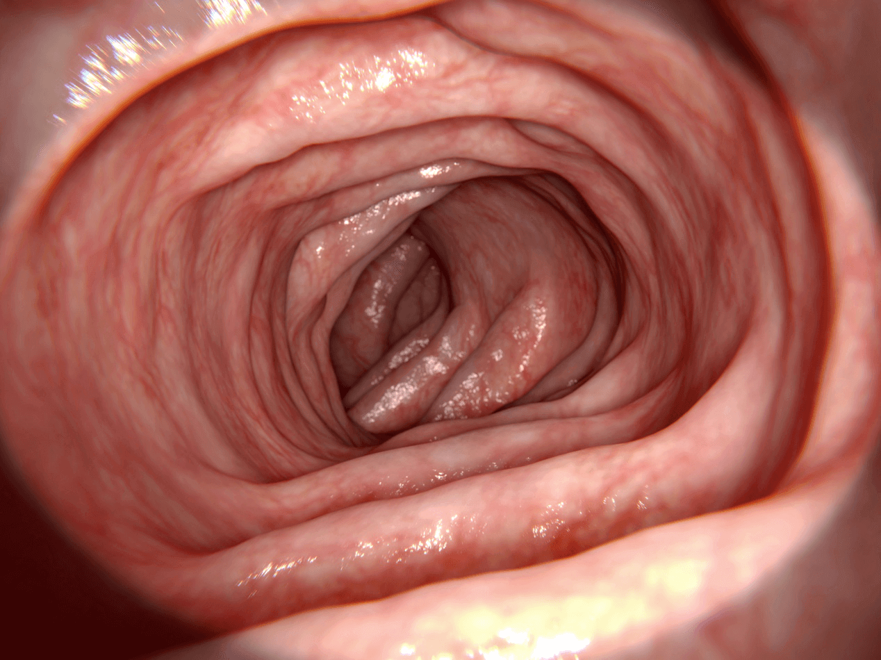 Colonoscopy